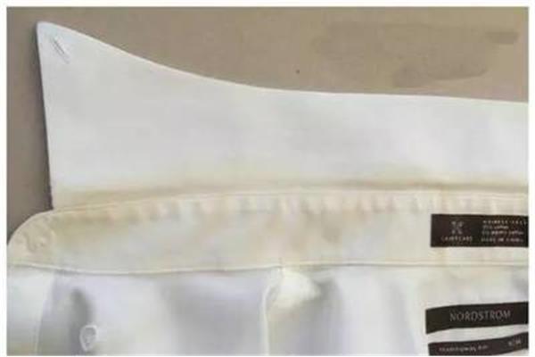 衣服领子发黄怎么洗