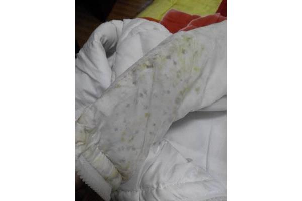 羽绒服发霉怎么洗掉霉斑